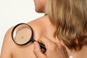 Атерома - распространенное заболевание кожи: симптомы и лечение - Подрастем